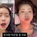 우리집한의원 | 명동 한의원 회현역턱관절치료 안면비대칭 침 교정 잘하는 곳 후기