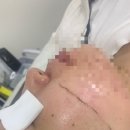 두산사우나 | 뷰티] 얼굴 각질부터 솜털까지 제거하는, 피부결 정돈을 위해 필요한 ‘뽐온뷰티 두산점, 스킨플래닝 후기