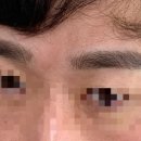 이엠브로우