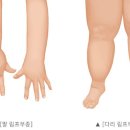 더조은한방병원 네이버블로그