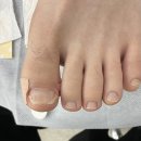 세븐일레븐 화성봉담주공점 | 화성 봉담 내성발톱 파고드는발톱 발라발라네일 봉담점에서 말끔히 해결