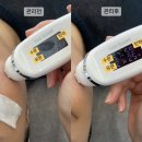 경북솔약국 | 경산피부관리전문/ 후기가 좋은 솔에스테틱 경산점