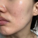 보고약국 | 도미나크림 부작용 및 효과 약국 기미크림후기