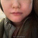 치과의정석치과의원 | 임신 중기 사랑니 발치, 솔직 후기