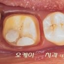 지니세라믹 이미지