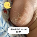 반곡중앙약국 | 내돈내산 사용후기💁 - 유리아크림