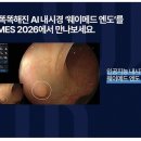 엔도웨이 이미지