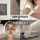서면윤곽관리 잘하는곳 코아페이즈 턱살 하이푸 후기