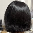 새싹약국 | 30대 여자 다발성 원형탈모 사행성 탈모 치료 후기