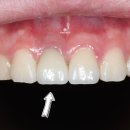 이편한치과기공소 이미지