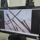강남역 smp 더빌리컴퍼니 더빌리스칼프 잔흔커버까지 섬세해!