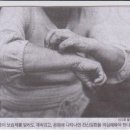 노인 전신 가려움증, 빈혈.당뇨병 신호일 수도 이미지