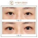 라이블리성형외과의원 이미지