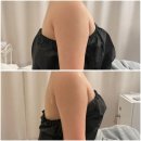 (주)숨은바디라인찾기 | [강남구청역 웨딩관리] 드레스 라인 관리 팔뚝살 박살!! 숨은 쇄골 찾기 후기