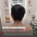 지에스(GS)25 사송더샵데시앙점 | 사송에스테틱 예뻐졌다 양산사송점 두피관리 승모근관리
