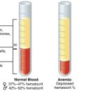 hematocrit(전체 혈액중 적혈구가 차지 하는 비율) 이미지