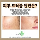 성진내과의원 네이버블로그