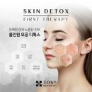 올스킨