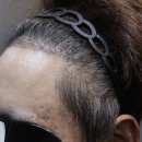 압구정모비앙의원 이미지