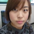 단델리온(Dandelion) 이미지