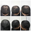 블랙샌드뷰티 이미지