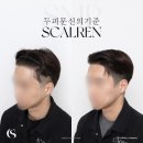 흥미헤어라인 이미지