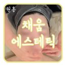 원흥피부관리 채움에스세틱 원장님의 1:1 수기관리 후기