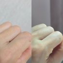 해운대 레이저제모 효과, 내돈내산 젠틀프로맥스 후기 가격 통증