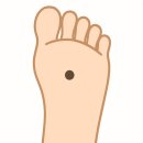 아로하피부과의원 | 발바닥 점 !! 흑색종 일까? 조직검사 후기