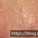 남재희삼성피부과의원 이미지