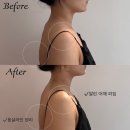 (유)새만금공인중개사사무소 | 부산 마사지샵 &#34;우아로움 서면점&#34;에서 셀포랩과 더조각 관리로 힐링한 솔직후기