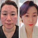 글로벌뷰티점인셀덤 | 피부 보정의 신세계! 인셀덤 쉬어 글로우 비비, 모공 실종 & 광채 폭발 레시피 공개 ✨