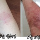 하얀피부사랑 이미지