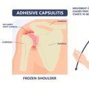 필라테스(재활운동/야간) 이미지