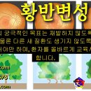 안구통 원인과 치료 - 사암오행침, 사암침법, 오행침, 정통사암침 이미지