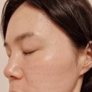 레티젠 콜라겐주사 2주 후 후기