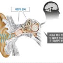 청각장애 이미지