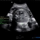 동탄제일병원 이미지