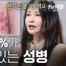 헤르페스 1형 2형 상관없이 위험한 거네 이미지