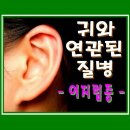 ★ 귀와 연관된 질병 – 어지럼증 ★ 이미지