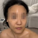 면목천로 | 상봉피부관리 세렌느에스테틱 재생폭탄관리 후기 전신 풀코스 힐링 상봉 에스테틱 강력 추천