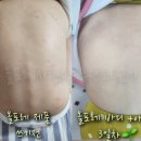 올포레코리아