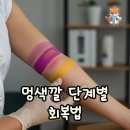 멍데이즈 | 멍색깔 단계로 보는 회복과정, 색깔 변화 순서 완벽 정리