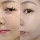 엘지프라엘 스킨부스터 사용후 화잘먹 피부된 후기 요즘 피부 컨디션은 스킨부스터 뷰티디바이스로 관리...