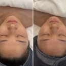 서화1 | [광주 웨딩관리] 서화에스테틱 :: 웨딩 5주 패키지 3단계 물광필 후기