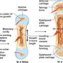 급성 혈행성 골수염[acute osteomyelitis] 이미지