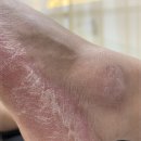 아우룸네일 이미지