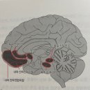 전두상회
