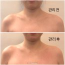 손길이닿다 | 율하 라운드숄더 관리 손길이닿다 후기
