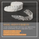 위스마일치과교정과치과의원 네이버블로그